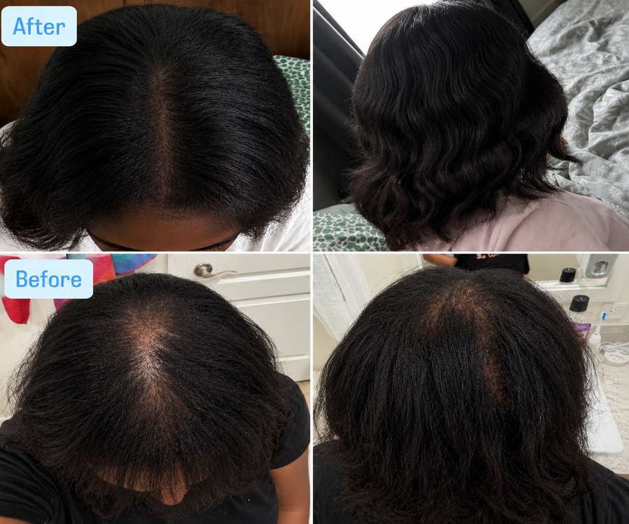 Rooted Hair Skin & Nails Gummies