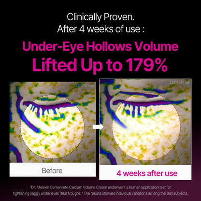 Korean Calcium Dark Spot Eye Cream