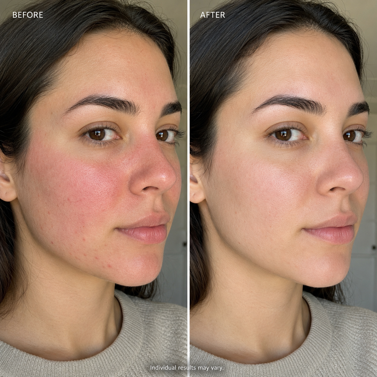 3H Redness Reset Relief Cream