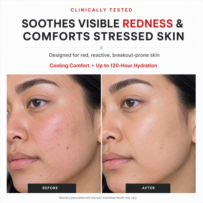 3H Redness Reset Relief Cream