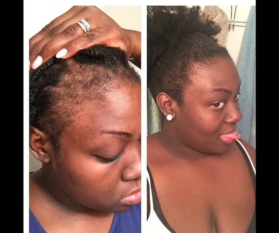 Rooted Hair Skin & Nails Gummies